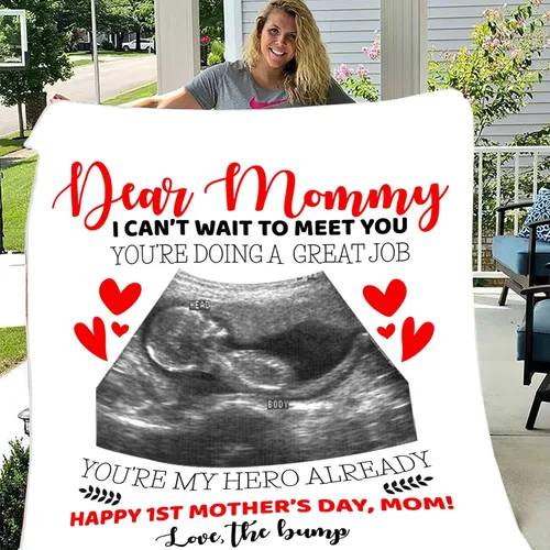 Miniatura 5 de Manta de fotos personalizada con ecografía para padres, manta de ultrasonido para primera vez, mamá y papá, imagen de ecograma personalizada única