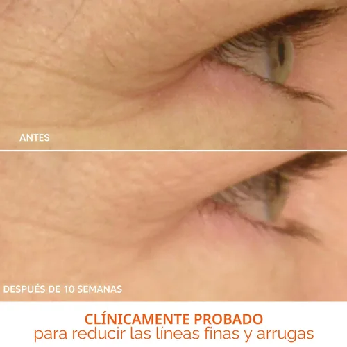 Miniatura 6 de Dr Dennis Gross DRx SpectraLite Eyecare Max Pro