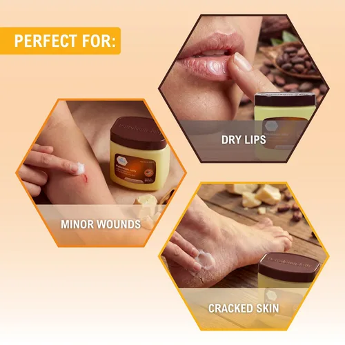Miniatura 3 de MED PRIDE Manteca de Cacao y Vaselina, 8 onzas – Protector de la piel hidratante para piel seca, manos agrietadas, talones ásperos, labios