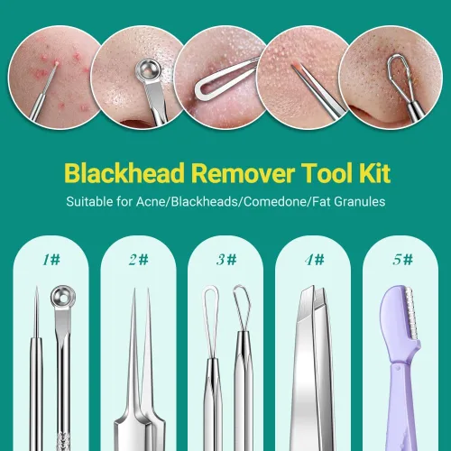 Miniatura 2 de TsMADDTs Kit de herramientas para reventar espinillas, 6 herramientas para eliminar puntos negros para cara y nariz, kit de depilación encarnada
