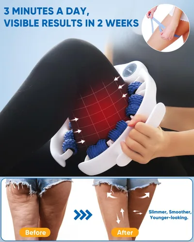 Miniatura 3 de ONUEMP Herramienta de Masaje para Celulitis, Removedor de Celulitis con Drenaje Linfático para Piernas, Rodillo Muscular para Masaje de Fascia