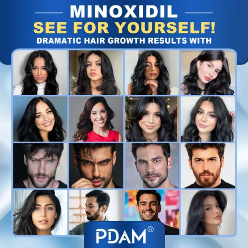 Miniatura 8 de Minoxidil para el crecimiento del cabello para hombres y mujeres, 2 onzas líquidas (paquete de 4 goteros)