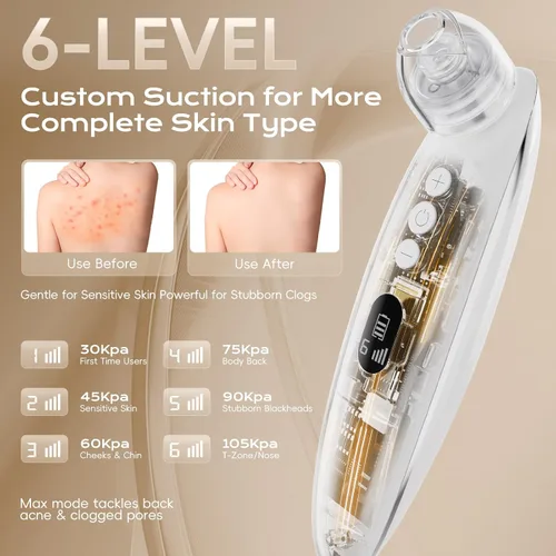 Miniatura 3 de Removedor de puntos negros faciales, extractor de puntos negros, herramienta de limpieza facial con ventosa recargable, kit de limpieza de poros