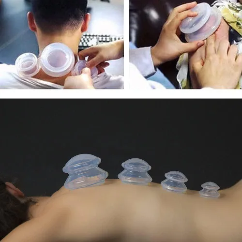 Miniatura 6 de Shinefuture Juego de terapia de ventosas, kit de 5 piezas de silicona para masaje, masajeador de celulitis, ventosas para masaje corporal