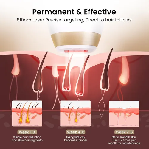 Miniatura 5 de DermRays Depilación láser para mujeres y hombres, V4S para tono de piel 1-5, reducción permanente en el crecimiento del cabello, el primer Blanco
