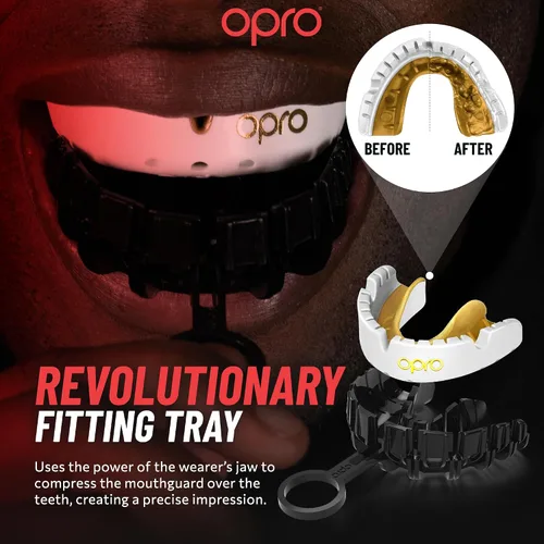 Miniatura 4 de OPRO Gold Level Braces Protector Bucal, Protector Bucal Moldeable para Comodidad y Ajuste para Boxeo, Hockey, MMA, UFC, Fútbol, Protección de Ufc