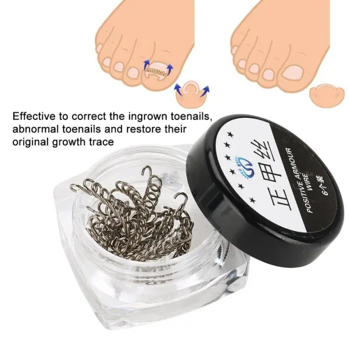 Miniatura 5 de Corrector de uñas pedicura herramienta de cuidado de pies, 12 unids/caja de herramienta de corrección de uñas de los pies, 6 tamaños encarnados