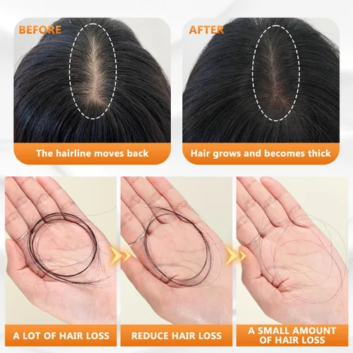 Miniatura 3 de Champú anticaída para la caída del cabello, champú anti caída del cabello, champú anti-caída promueve el crecimiento del cabello, champú de rutina