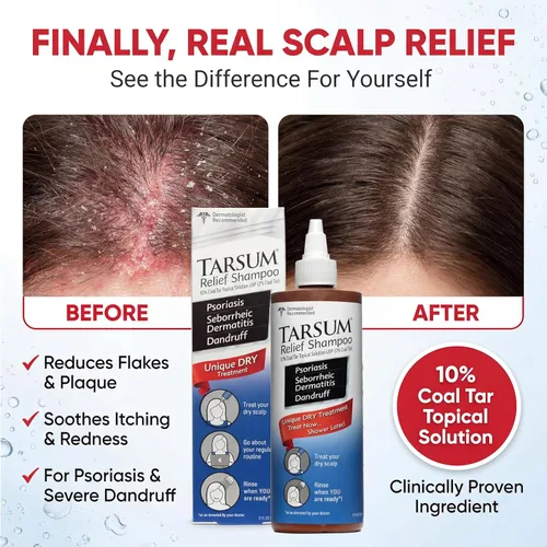 Miniatura 2 de Tarsum Champú para psoriasis extra fuerte, champú y acondicionador de alquitrán de carbón para psoriasis del cuero cabelludo, dermatitis seborreica