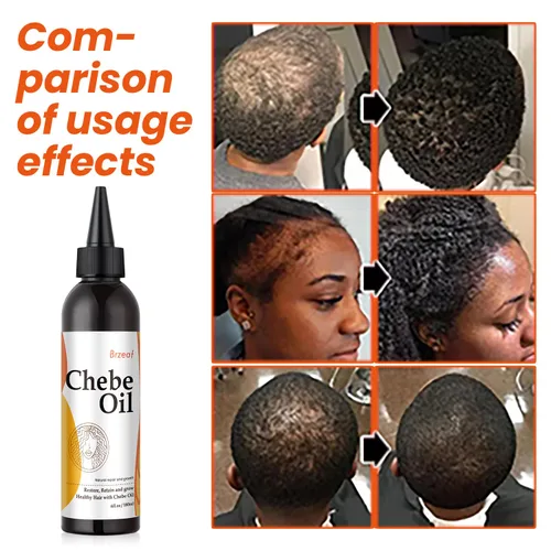 Miniatura 7 de Brzeaf Aceite de Chebe natural para la nutrición del cuero cabelludo y el crecimiento del cabello (6 onzas) - Auténtico polvo chadiano Chebe