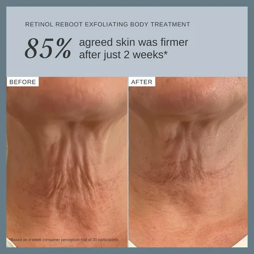 Miniatura 6 de Alpha-H Retinol Reboot Tratamiento Corporal Exfoliante 4.1 fl oz - Firme, Suaviza e ilumina la piel del cuerpo - Reduce la apariencia de líneas