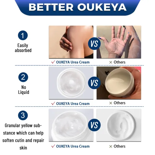 Miniatura 4 de OUKEYA Crema de urea 40% con 2% ácido salicílico intensivo para pies, manos y cuerpo para piel muy seca, agrietada y áspera en talones, rodillas