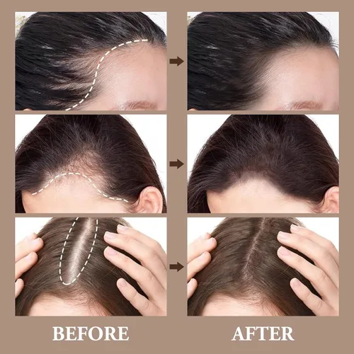 Miniatura 3 de Polvo para cubrir el cabello gris, doble cubierta de cabeza gris con esponja y cepillo, polvo de contorno impermeable para pérdida de cabello fino