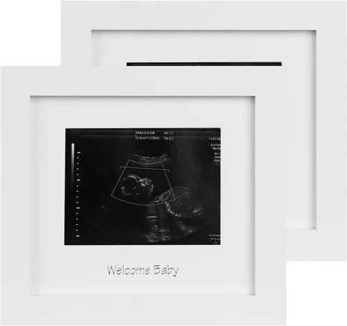 Miniatura 14 de IHEIPYE Marco de Embarazo de Triple Sonograma – Marco de Fotos de Ultrasonido de Bebé con Historia para Futuros Padres, Marco de Baby Shower, Marco