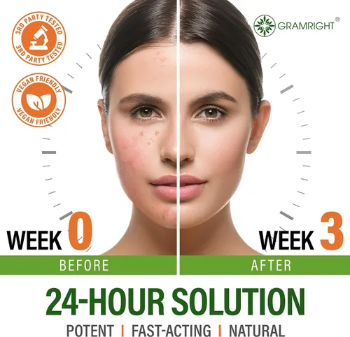Miniatura 4 de Crema facial para el acné - Tratamiento de manchas de acné para la cara y puntos de acné - Aceite de árbol de té y ácido salicílico - Tratamiento