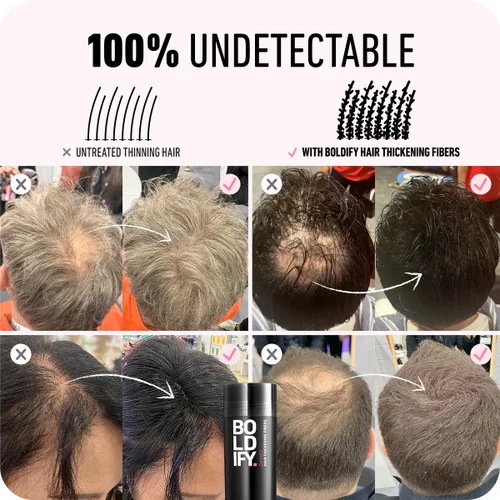 Miniatura 6 de Boldify Build & Conceal Bundle - Fibra capilar y polvo de línea capilar (rubio oscuro): espesante indetectable para cabello fino, retoque