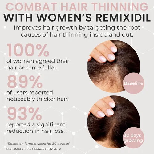 Miniatura 4 de Vitaminas para el Crecimiento del Cabello Suplementos para el Crecimiento del Cabello para Mujeres Apoya el Grosor y la Fuerza Ayuda a Reducir