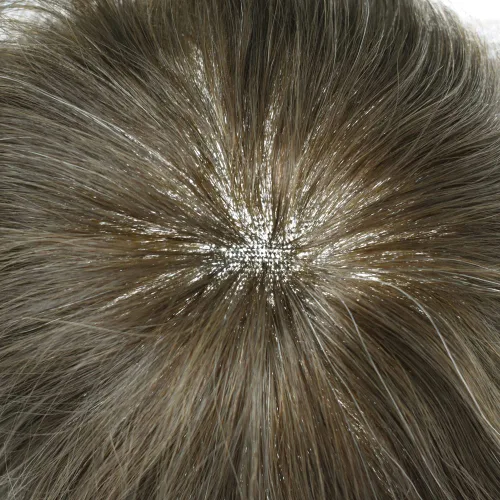 Miniatura 38 de Sistema de repuesto de cabello humano europeo con encaje frontal suizo para hombre, tupé para hombre, pieza de cabello, nudo blanqueado, línea #17