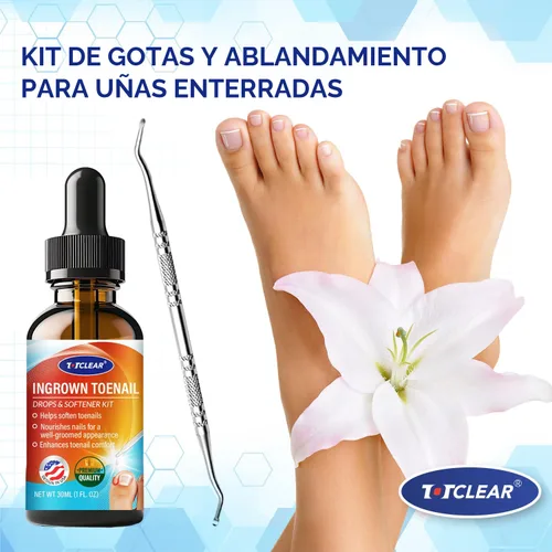 Miniatura 7 de Alivio de Uñas Encarnadas: Herramienta para Uñas Encarnadas para Hombres Mujeres - Kit de Eliminación de Uñas Encarnadas - Gotas Correctoras de Uñas
