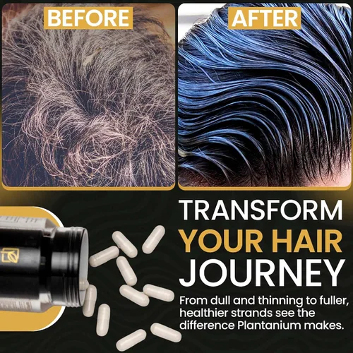 Miniatura 7 de Las mejores vitaminas para el crecimiento del cabello para mujeres y hombres apoyan el crecimiento del cabello más rápido y una mejor salud