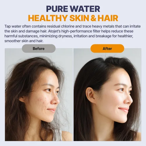 Miniatura 7 de Filtro de ducha Aqua Detox influenciado por la tradición de belleza de Corea, alivia la sequedad y la irritación mientras mejora la salud de la piel