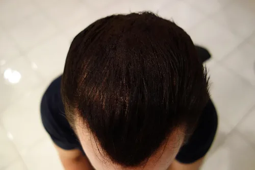 Miniatura 4 de Fibras de queratina para construir cabello Finally Hair, repuesto de 0.88 onzas, Café Oscuro Marrón oscuro con tono rojizo