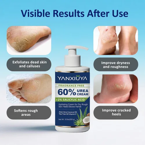 Miniatura 4 de Crema de urea 60% de 10.5 onzas, loción corporal sin fragancia con 2% de ácido salicílico, crema de pies y para pies, talones agrietados, removedor