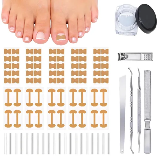Kit corrector de uñas encarnadas con tiras de corrección flexibles y cinta – Juego de herramientas profesionales de pedicura en el hogar para