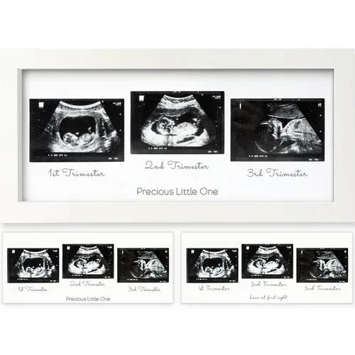 Miniatura 11 de KeaBabies Marco de Fotos de Ecografía para Bebé - Marcos Modernos de Fotos de Ultrasonido para Futuras Mamás, Regalos de Primer Embarazo para Mamá