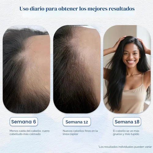 Miniatura 3 de Suero para el crecimiento del cabello roll-on con romero, ayuda a apoyar la apariencia del cabello más grueso y lleno, limpio y no graso