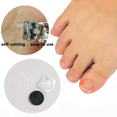 Miniatura 2 de Tratamiento de uñas encarnadas, 50 tiras correctoras de uñas encarnadas transparentes, herramienta profesional de tratamiento de uñas sin pegamento