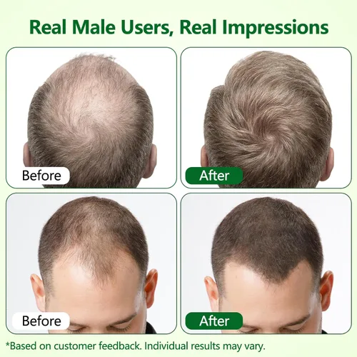 Miniatura 2 de Suero roll-on para el crecimiento del cabello, ayuda a reducir la caída del cabello y promueve un cabello más grueso y de aspecto más completo