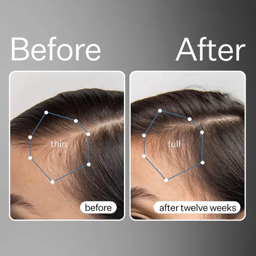 Miniatura 2 de Act+Acre - Suero de cuero cabelludo de células madre procesadas en frío, promueve un cabello más grueso y de aspecto más completo, calma e hidrata