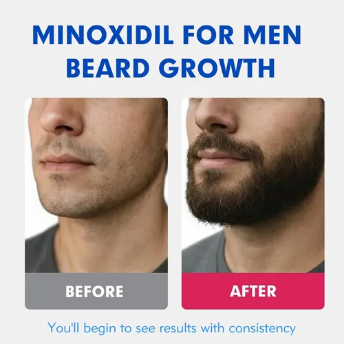 Miniatura 3 de Fytikal 5% de minoxidil para hombres tratamiento de crecimiento del cabello, solución tópica extra fuerte para adelgazamiento del cabello