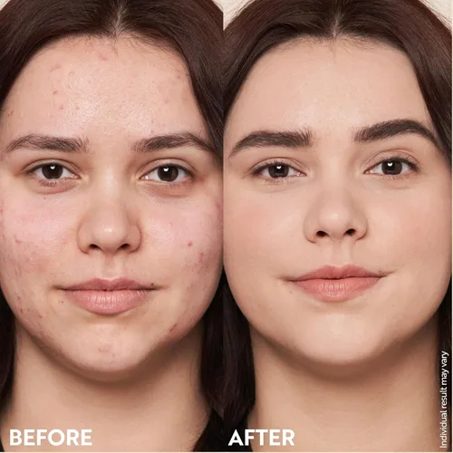 Miniatura 7 de Crema Ligera para rellenar arrugas – Reduce la apariencia de arrugas, enrojecimiento, de manchas e imperfecciones – Acabado mágico para brillos