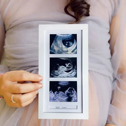Miniatura 6 de Marcos de fotos de ultrasonido triple, marco de fotos de sonograma, 3 fotos, anuncios de embarazo, regalos de embarazo para madres primerizas, Blanco