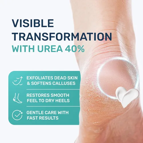 Miniatura 2 de Crema de urea 40 por ciento para pies de máxima fuerza, crema de urea para pies y removedor de callos, crema exfoliante para talones con ácido