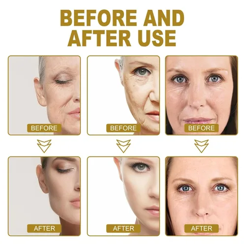 Miniatura 5 de Crema antiarrugas de colágeno, crema facial antienvejecimiento dorada, crema facial de colágeno para mujeres, antienvejecimiento, hidratante facial