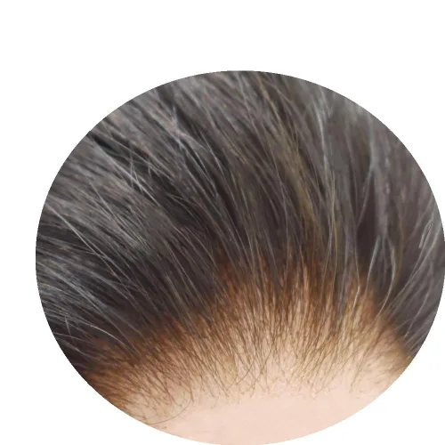Miniatura 57 de Peluca de repuesto de cabello natural de poliuretano con encaje frontal para hombre (7x9 pulgadas, densidad de luz, 1B40# negro natural con 40% gris)