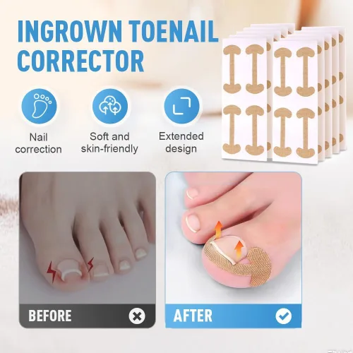 Miniatura 6 de Juego de corrector de uñas encarnadas, tiras correctoras de uñas curvas, lima sin dolor y herramientas de pedicura levantador para mujeres y hombres