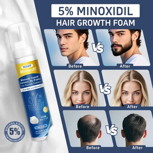 Miniatura 3 de Espuma de minoxidil, 5% de espuma tópica de minoxidil, infundida con biotina, tratamiento para el crecimiento del cabello, minoxidil para hombres