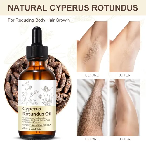 Miniatura 3 de Cyperus Rotundus Oil Hair Inhibitor Serum 2Pcs, Natural Painless Hair Removal for Women & Men, Slow Body & Facial Hair Regrowth, Moisturize Soothe