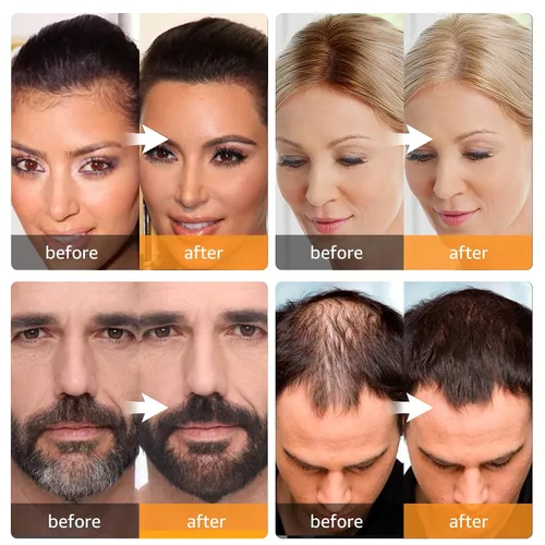 Miniatura 2 de Retoque de Raíz Instantáneo Polvo de Cobertura de Canas, Oculta la Pérdida de Cabello y Adelgazamiento Para Mujeres y Hombres, Fibras Capilares