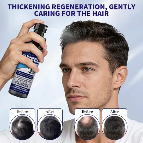 Miniatura 3 de Minoxidil para hombres y cabello Minoxidi con 5% de biotina de minoxidil y romero y para tratamientos de crecimiento de barba y cabello, solución