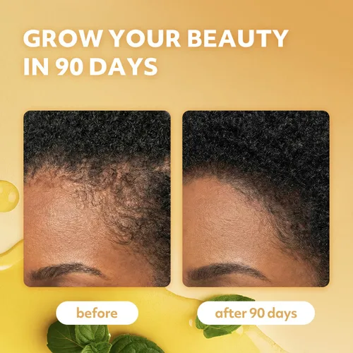 Miniatura 4 de Batana & Natural Oils Fórmula para el crecimiento del cabello, 12 en 1, aceite de cuero cabelludo y cabello de triple fuerza con batana, oliva, coco