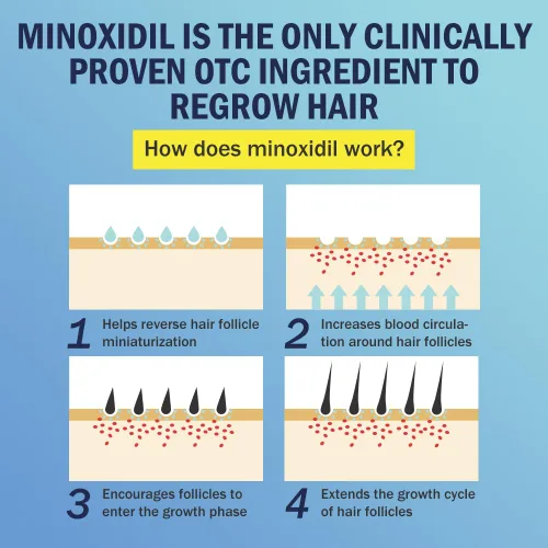 Miniatura 5 de Ruahouine Espuma de minoxidil al 5% para el crecimiento del cabello, tratamiento tópico de pérdida de cabello para hombres para que vuelvan a crecer