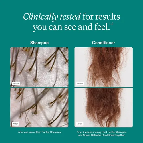 Nutrafol Champú y acondicionador, limpia y protege el cabello y el cuero cabelludo, mejora el volumen, la fuerza y la textura del cabello, formulado