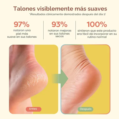 Miniatura 3 de ZenToes Calcetines de talón hidratante, 2 pares de calcetines de spa con forro de gel para curar y tratar talones secos y agrietados mientras Lila