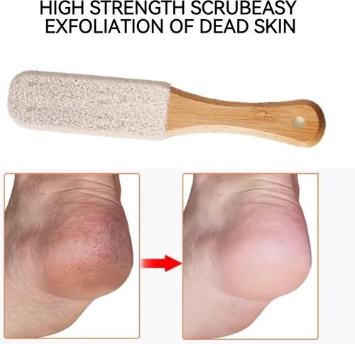 Miniatura 3 de Paquete de 2 limas de pedicura profesional con mango de madera y piedra pómez – Removedor de callos para pies y manos, limpiador de pies para piel