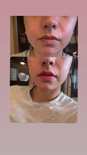 Miniatura 7 de Extreme Lip Plumping Lipgloss, Bold Volumizing Máxima Fuerza y Hormigueo Instantáneo, con colágeno, ácido hialurónico y vitamina E para labios